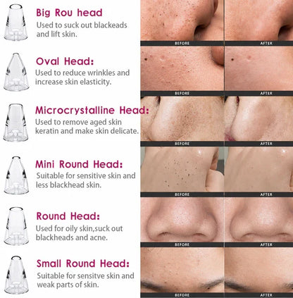 Premium Multi-Functional Black & Whitehead Remover For Pore & Pimples Cleaner Machine Men & Women
