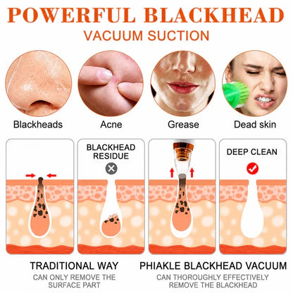 Premium Multi-Functional Black & Whitehead Remover For Pore & Pimples Cleaner Machine Men & Women